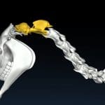 Das Atlanto-Axial Gelenk ist ein Zapfengelenk